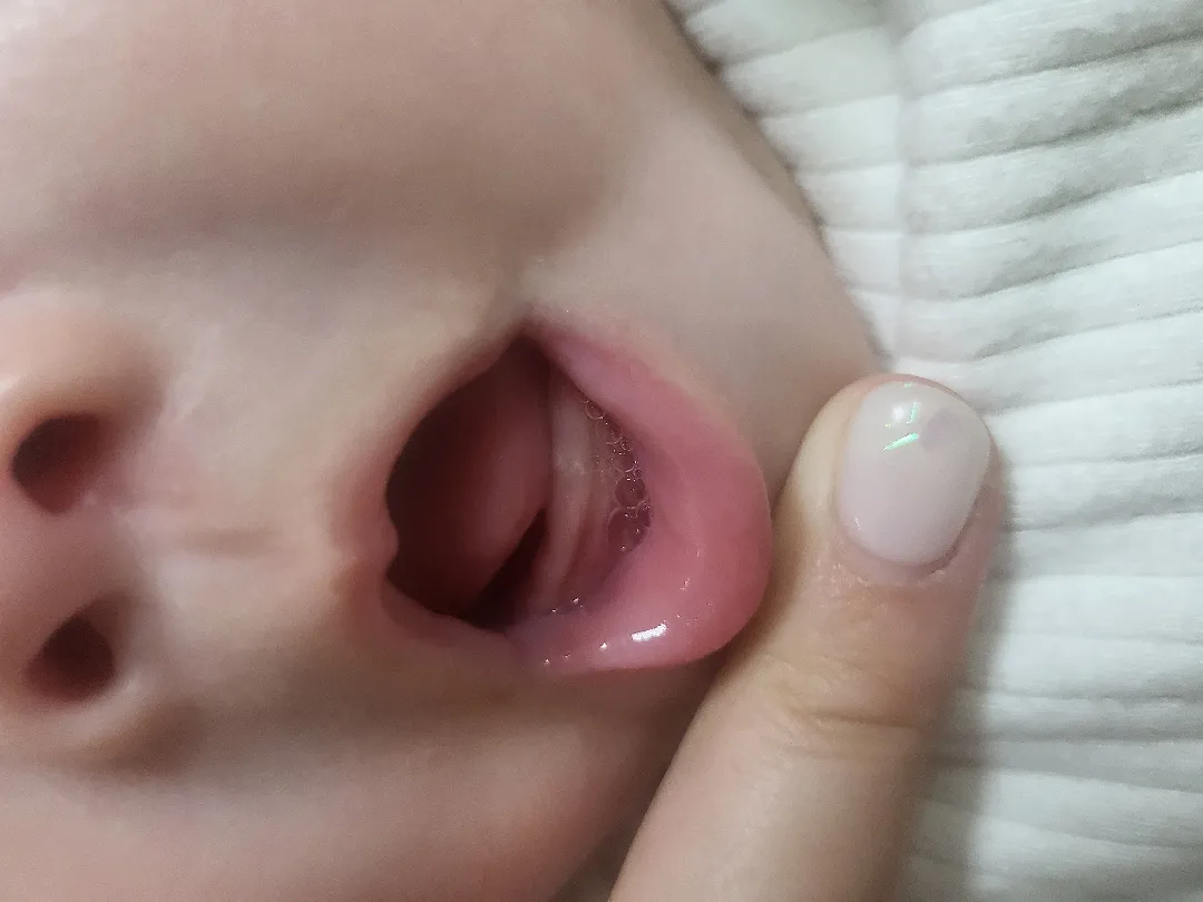 이것이 이🦷일까요~~?