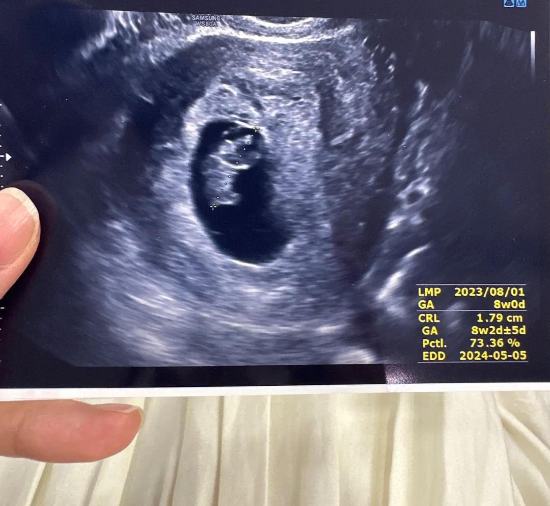 예정일이 5월 5일 어린이날이래요! 