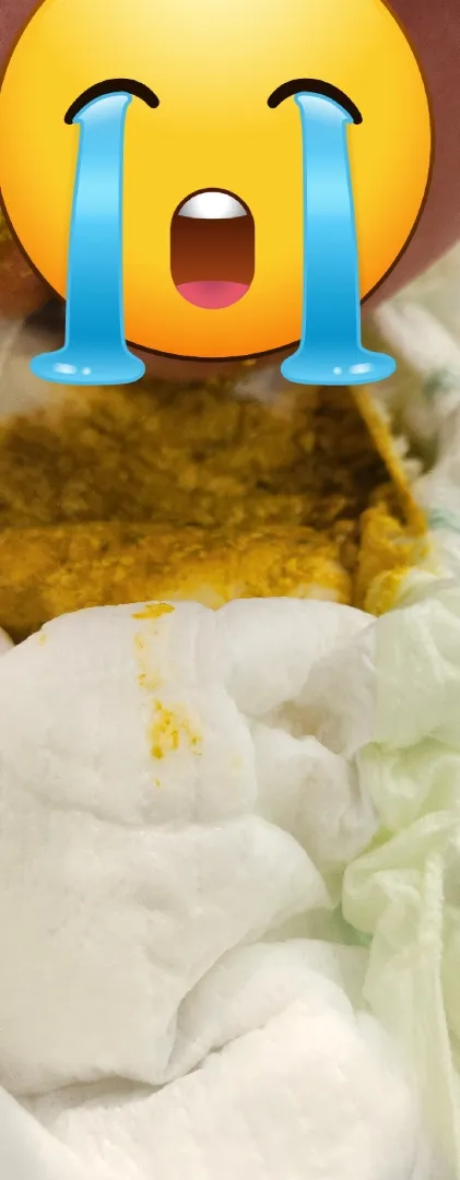 설사인지 궁금해요 변사진 주의