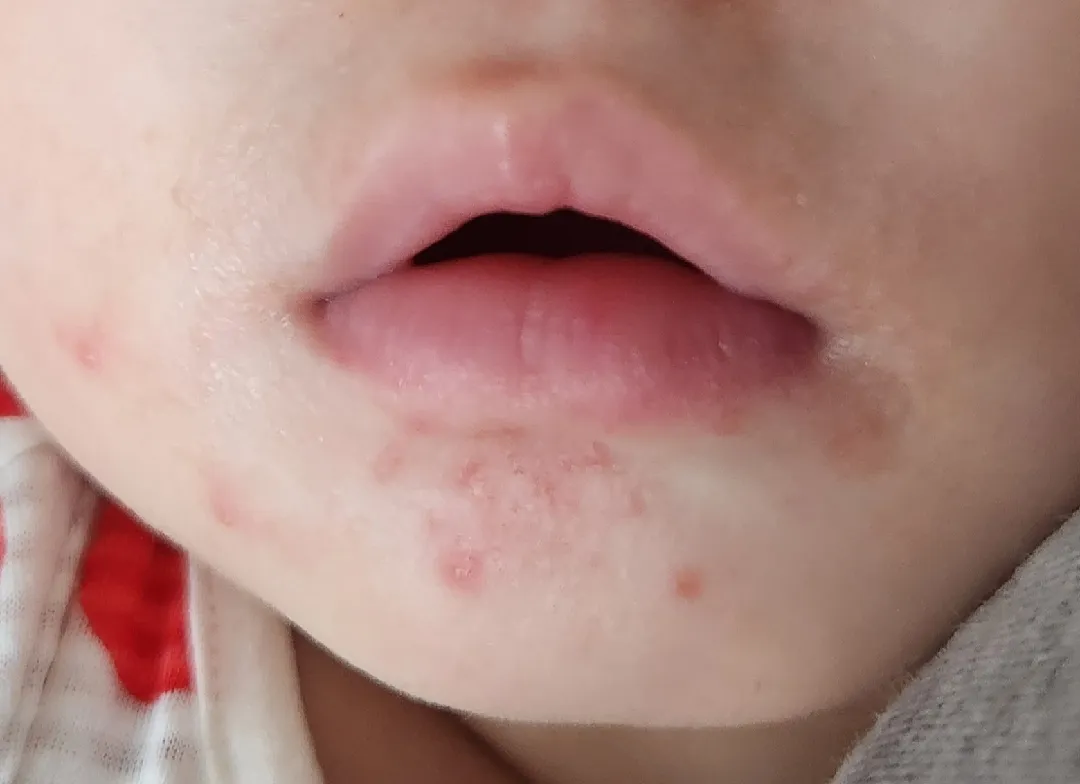 침독일까요???