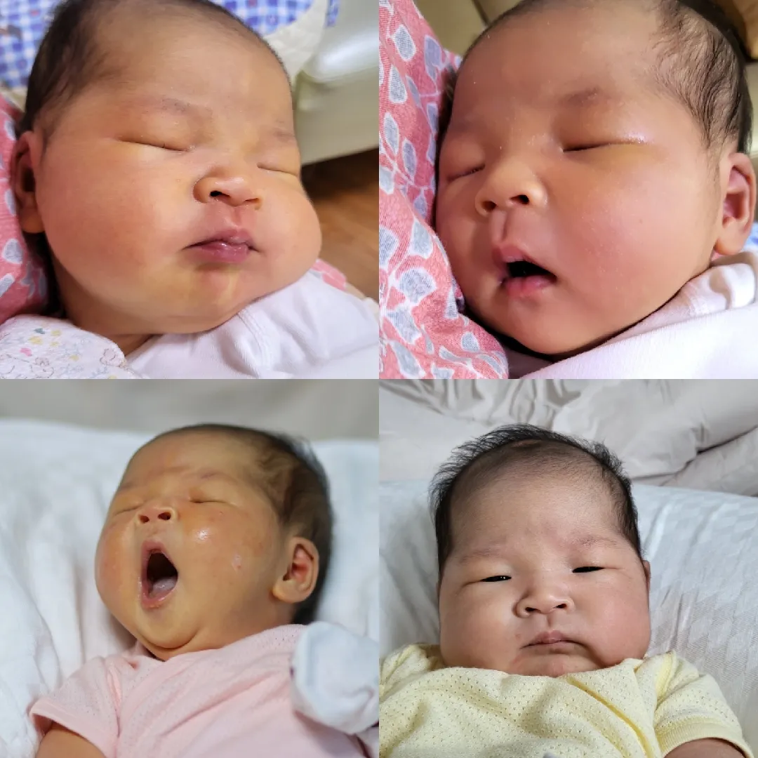 신생아 황달! 눈여겨 보세요!