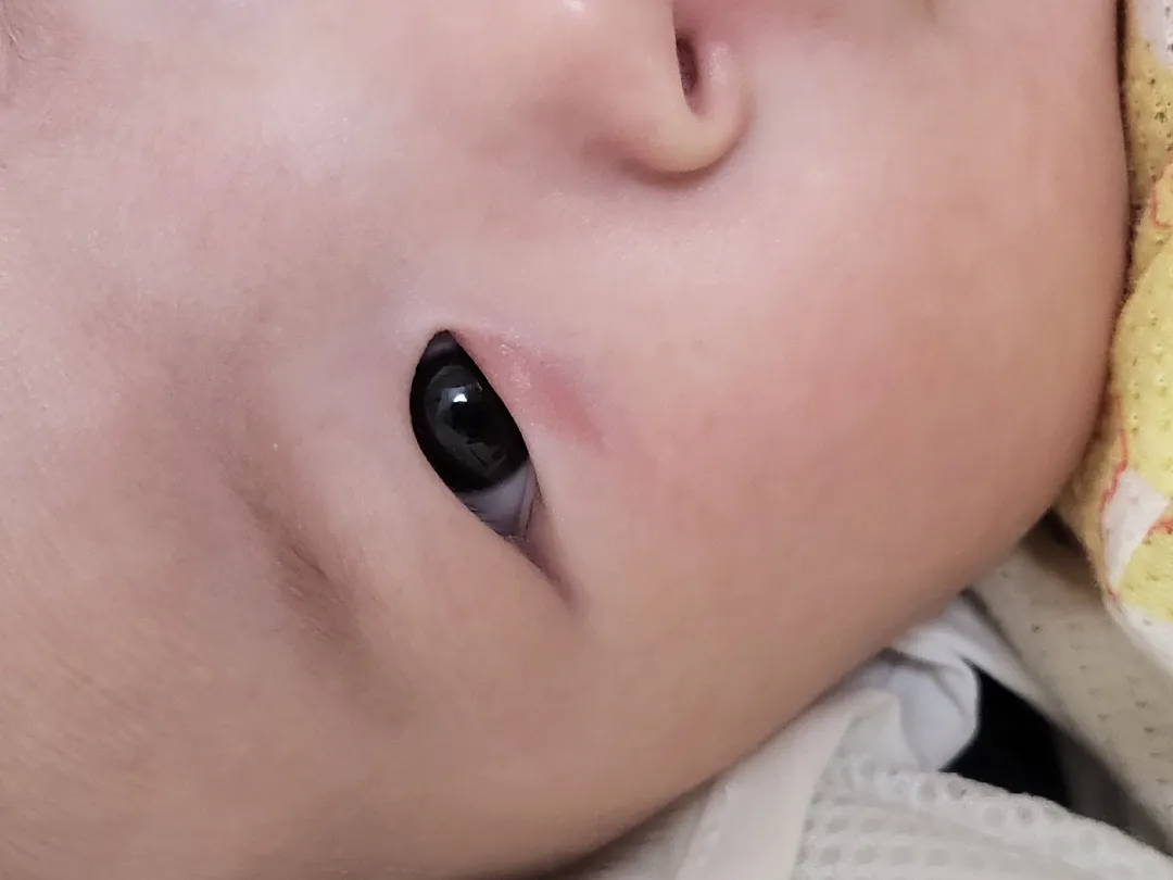 아기 눈 좀 봐주세요ㅠㅠ