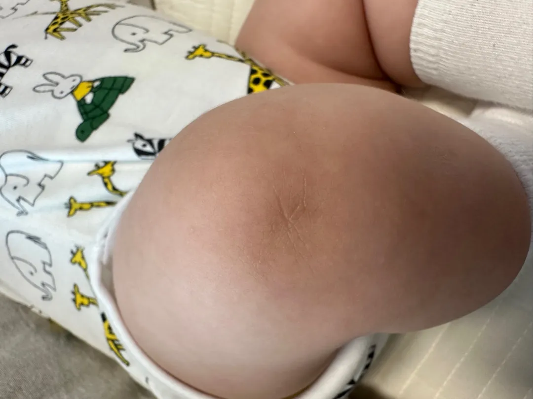 무릎
