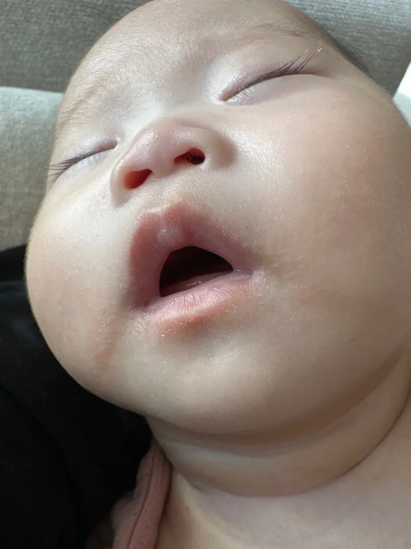 이제 침독 전쟁😓