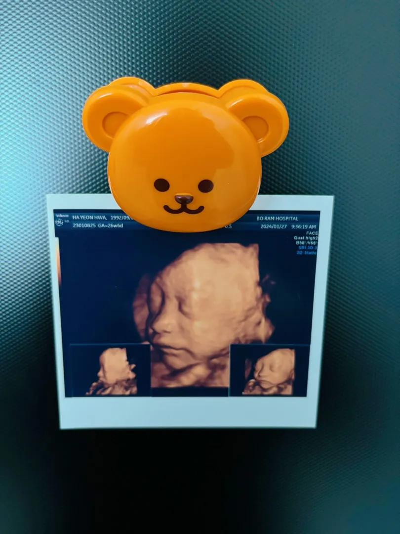 입체초음파 했어요🍒👶🏻