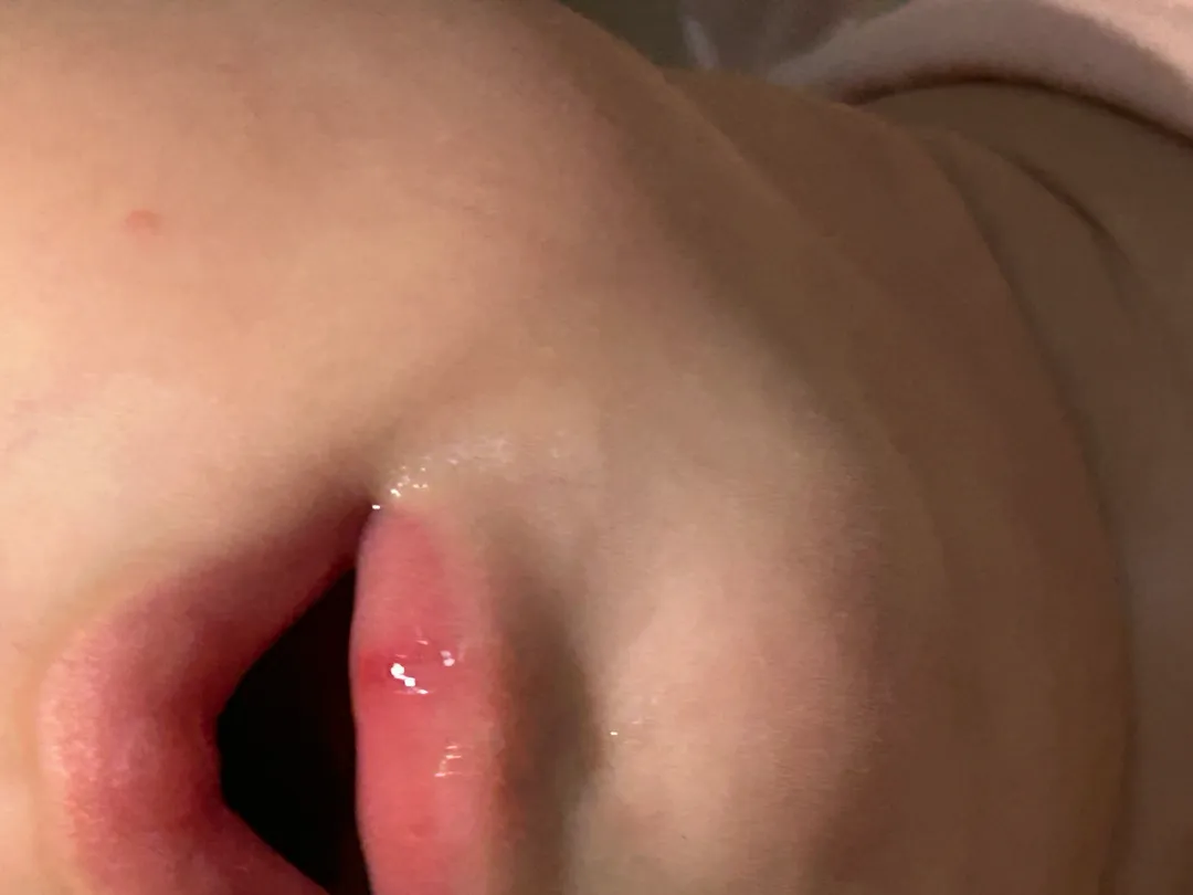 아기 입술 약 따로 발라야할까요?