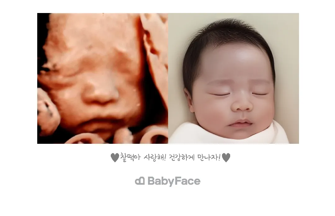 입체초음파 후에 다들 한다는 베이비페이스 해봤어요!