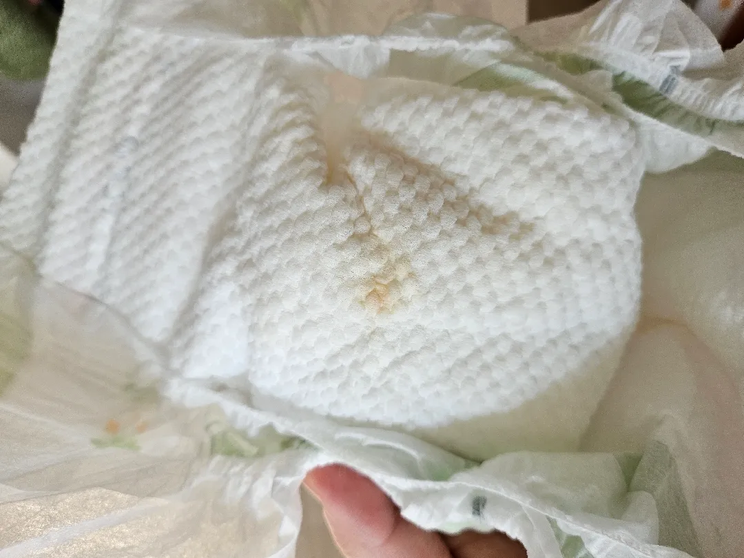 기저귀 소변중간에 빨간부분 봐주세요