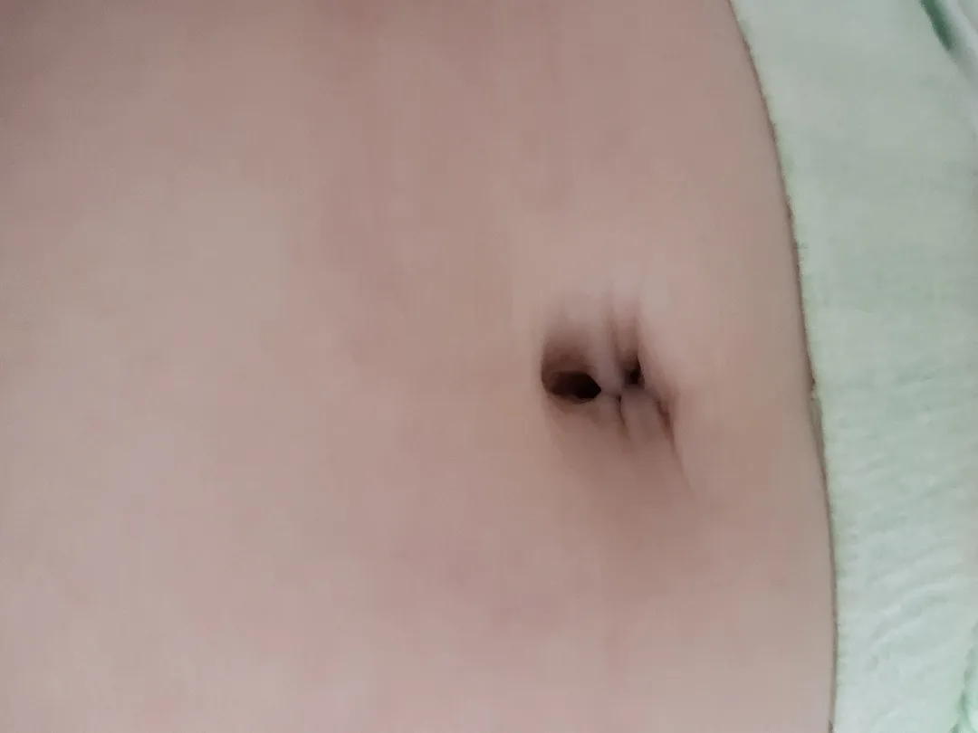 아기 배꼽좀 봐주세요!!