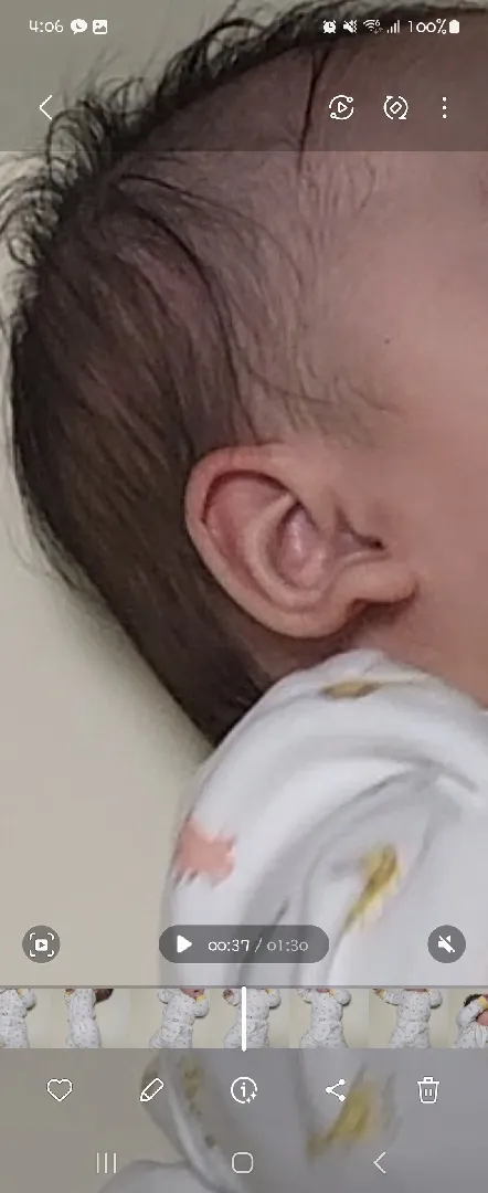 아기 귓볼 모양좀 봐주세요