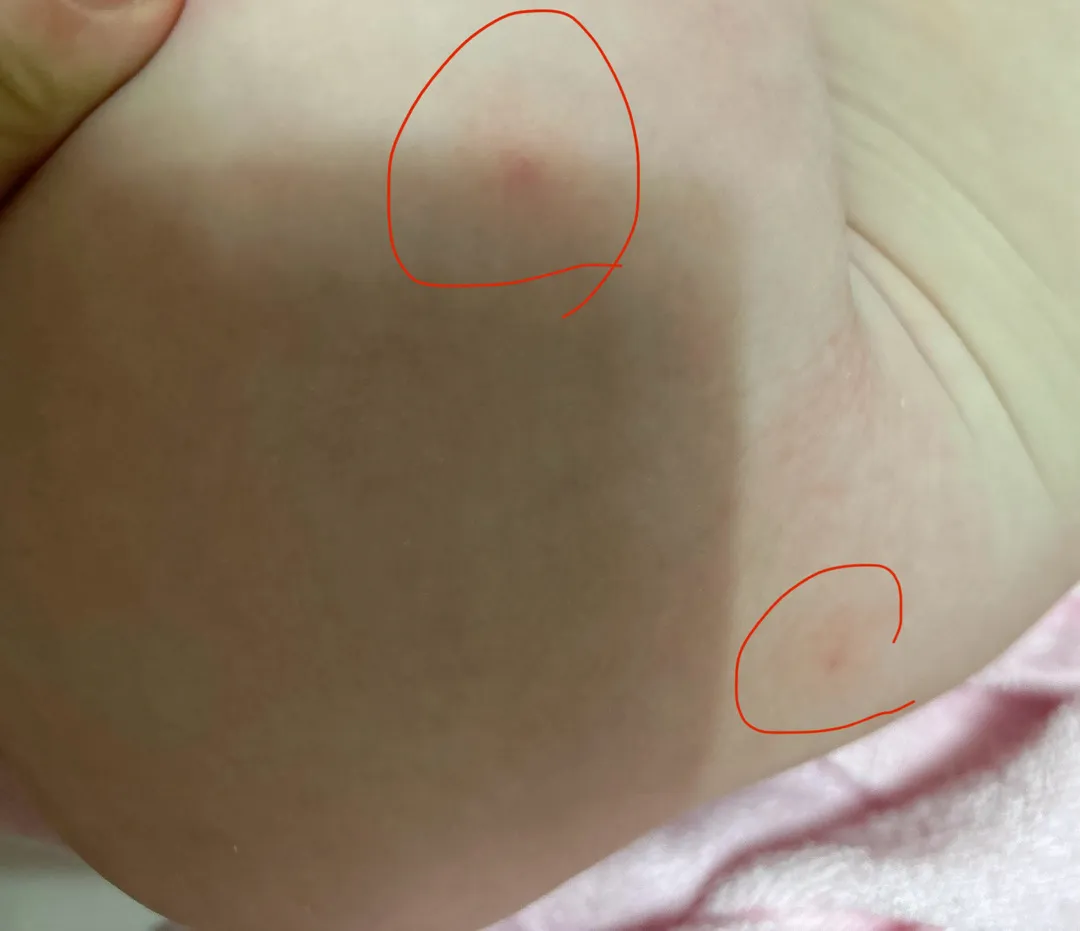 이유식알레르기인가요??
