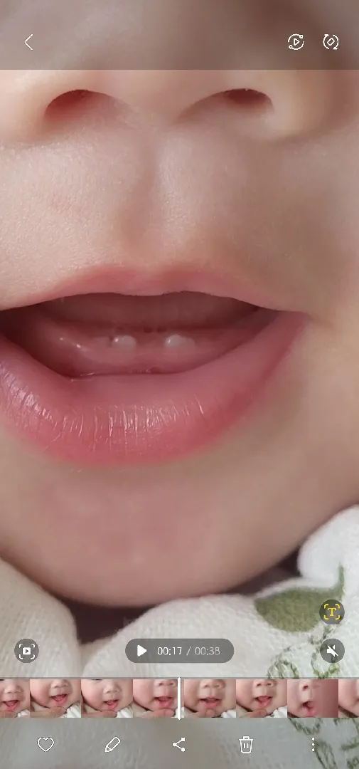 아랫니가 동시에 네개가 나기도 하나요..?