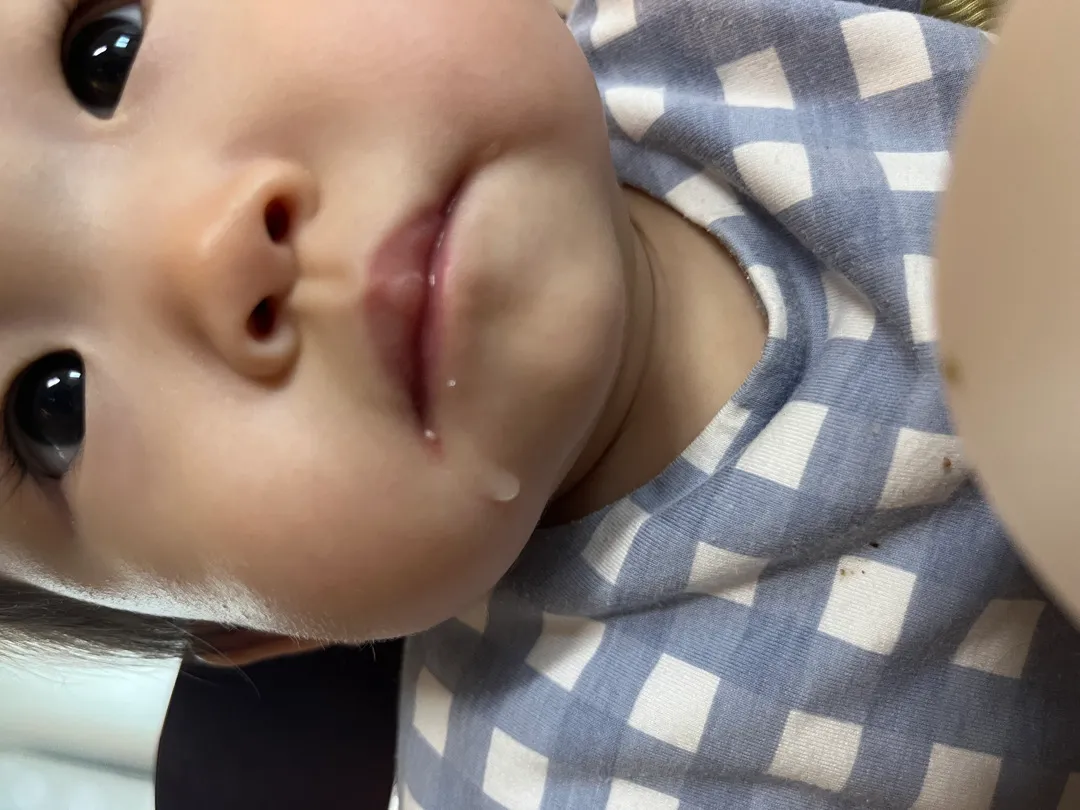 입술옆에난 이건뭘까요
