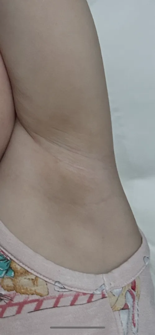 20개월 아기 겨드랑이 색 때일까요....?