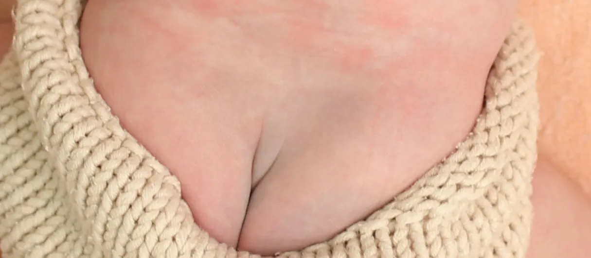 엉덩이 딤플