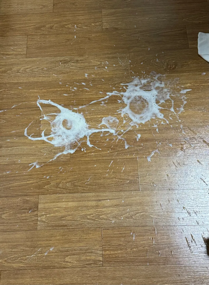 아기 분수토 ... 도와주세요 ㅠㅠ(사진 주의)