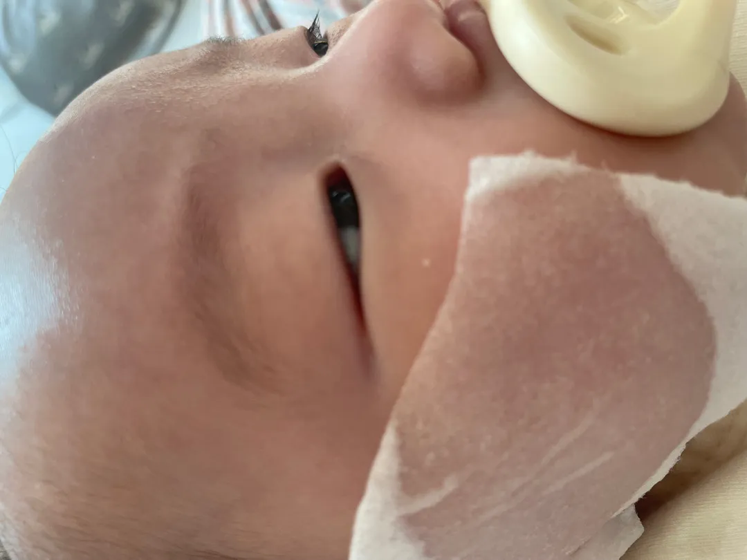 눈밑에 하얀것