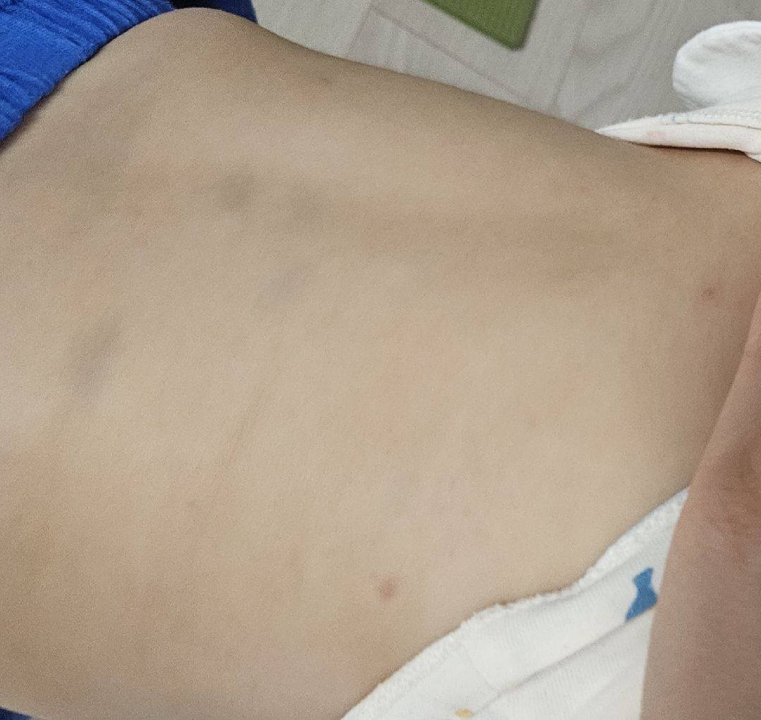 수족구 가능성 있을까요?