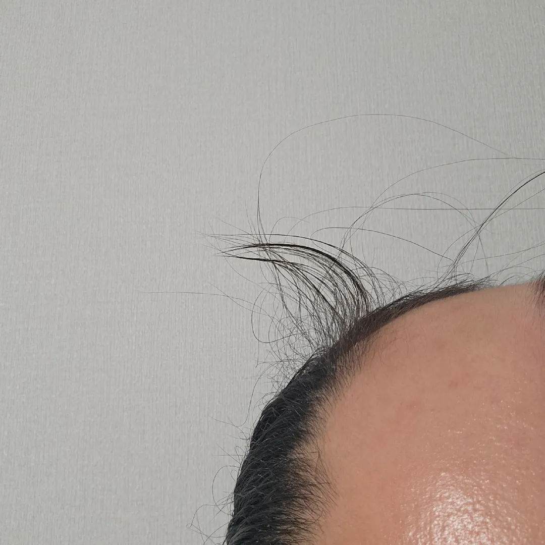 제 머리에 잔디밭 뿔이 났어요....