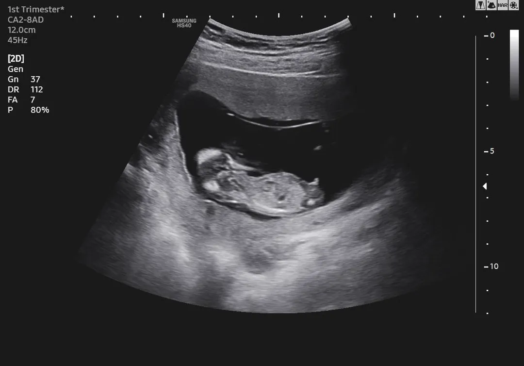 11주6일 각도법