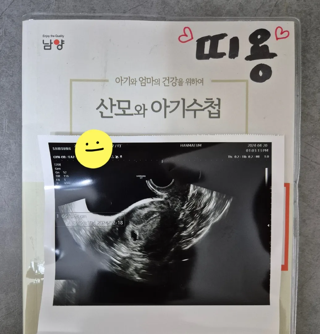 둘찌...아기집!!