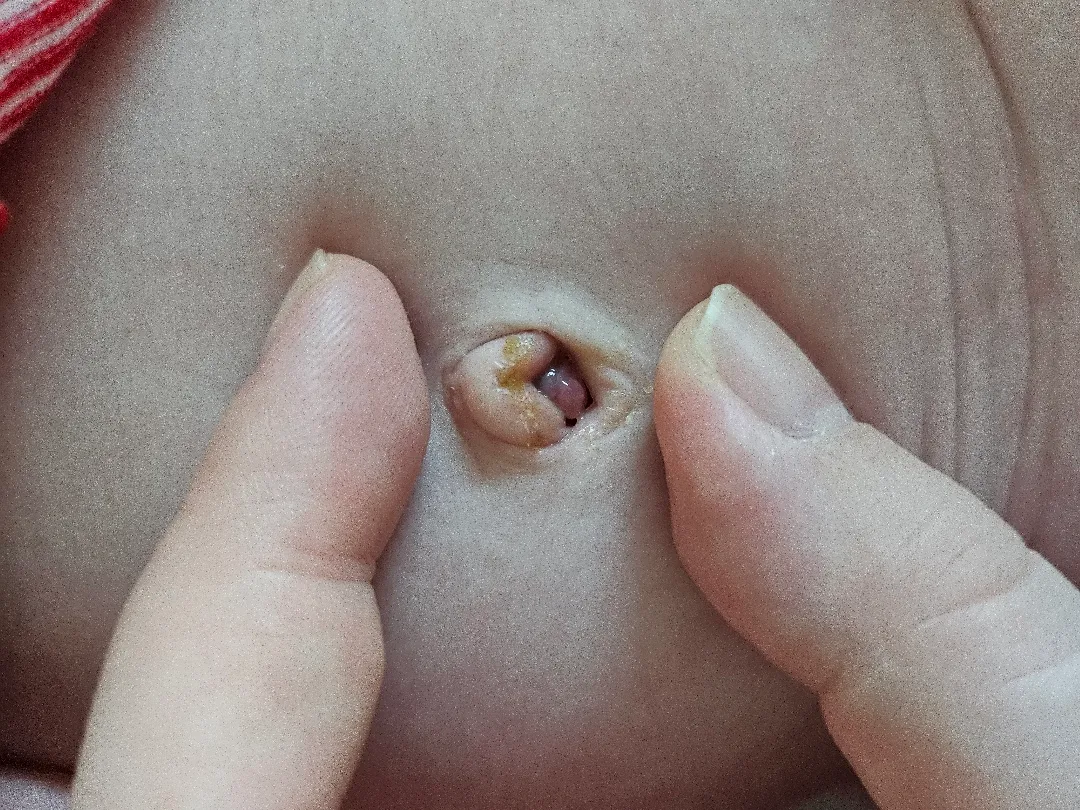 아기 배꼽