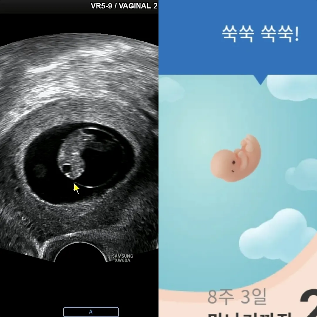 8주 젤리곰.....🐻