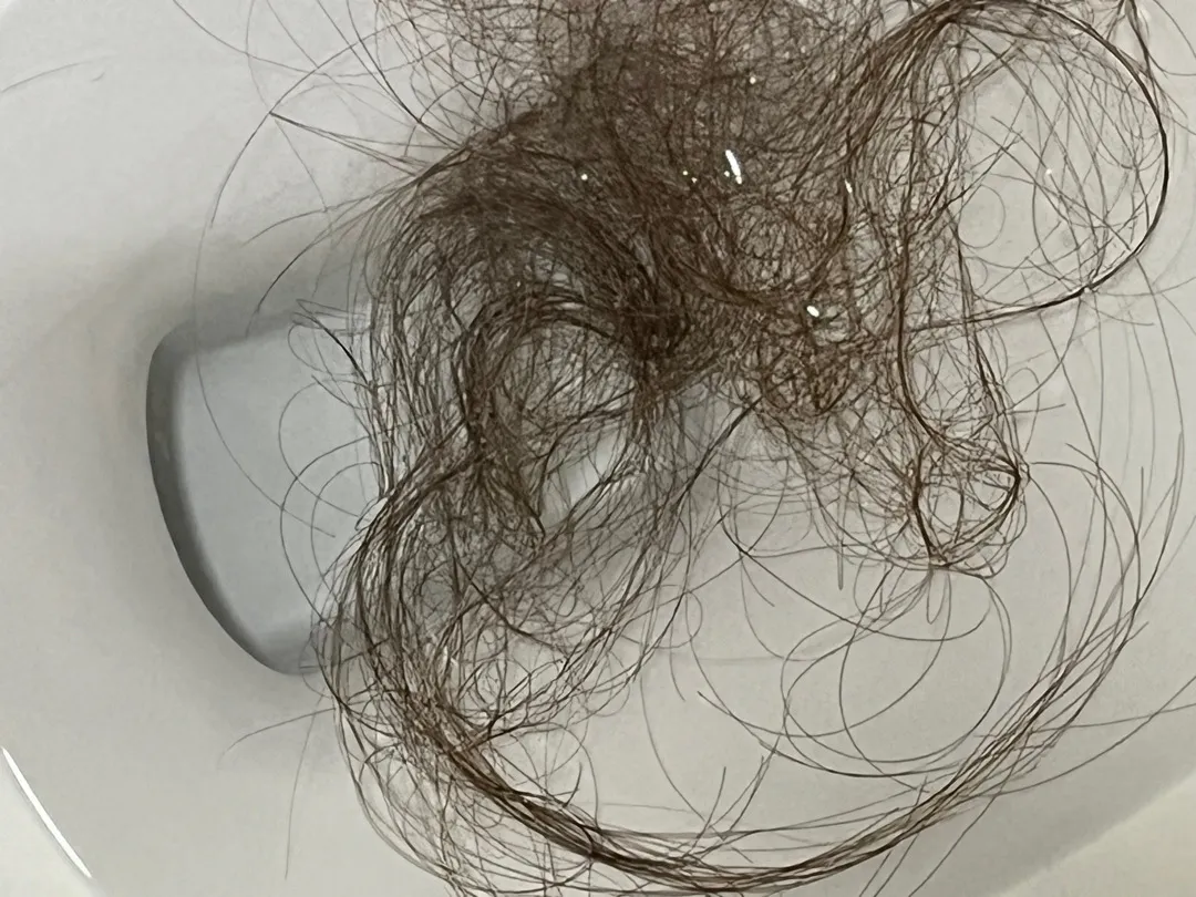 다들...머리카락 안녕하시나요?
