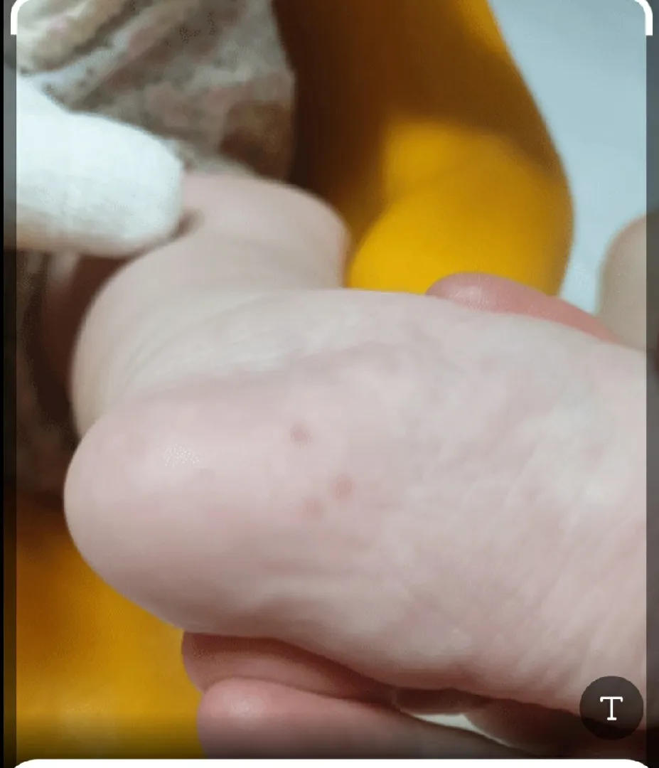 이게  뭘까요?ㅜㅜ