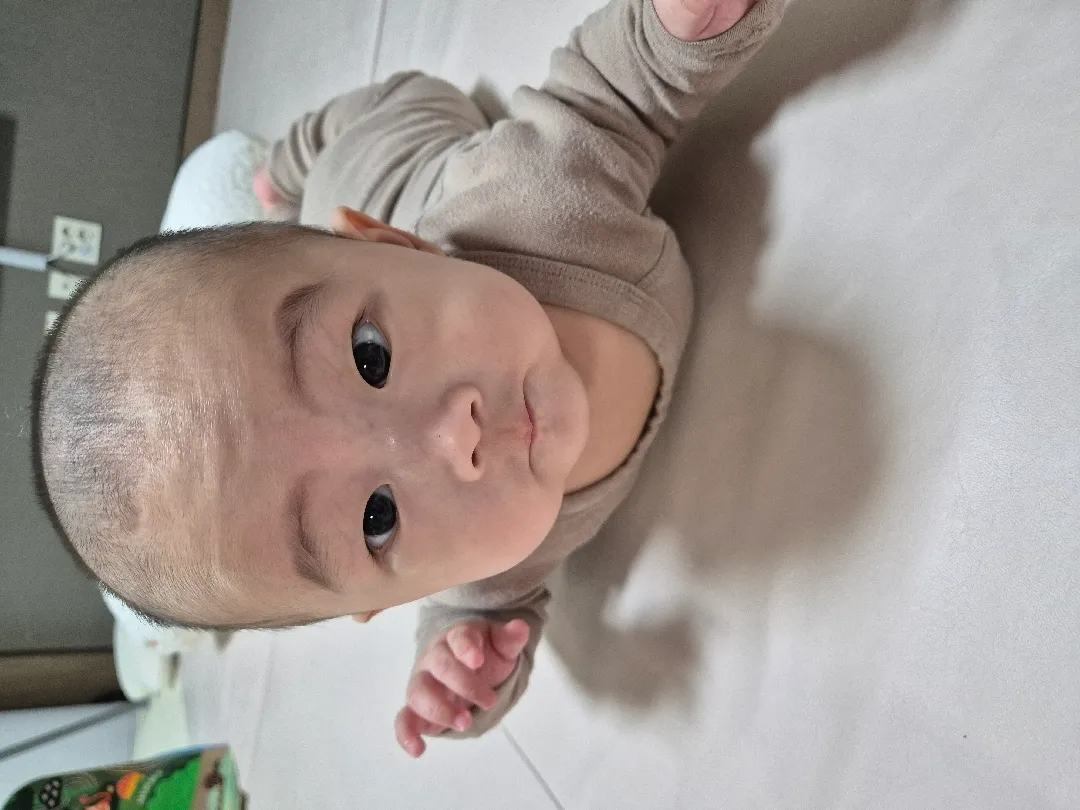 우리 햇살이 대머리빡빡이 됐어요