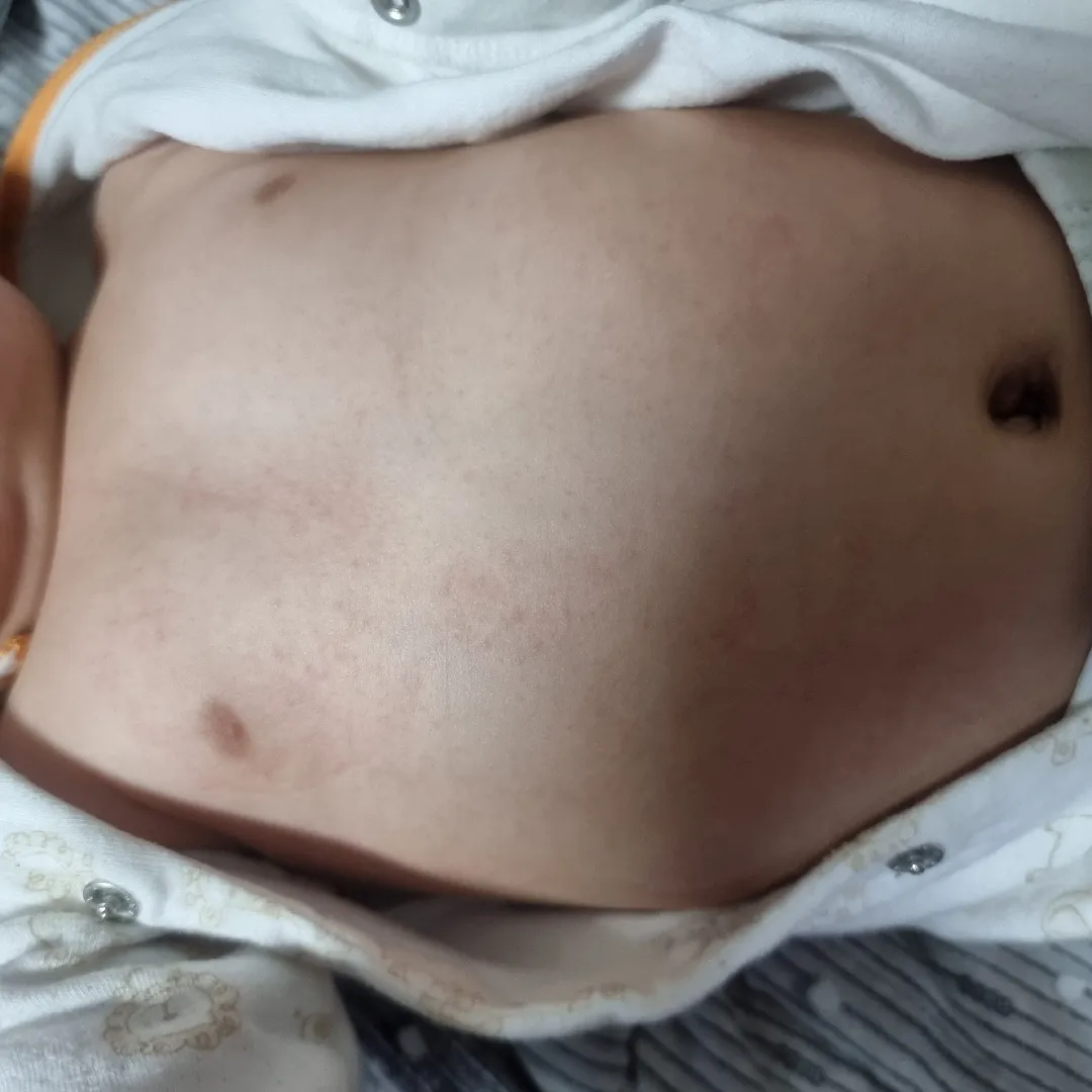 이유식때문인가요?