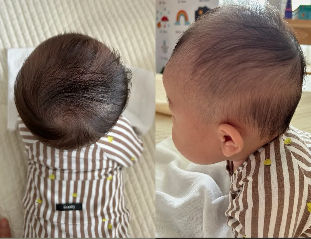 아기 두상 봐주세요