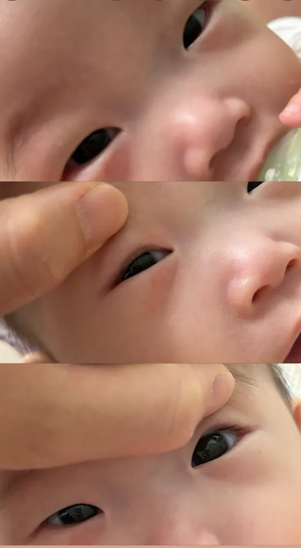 5개월 아기 숨겨진 속쌍커플