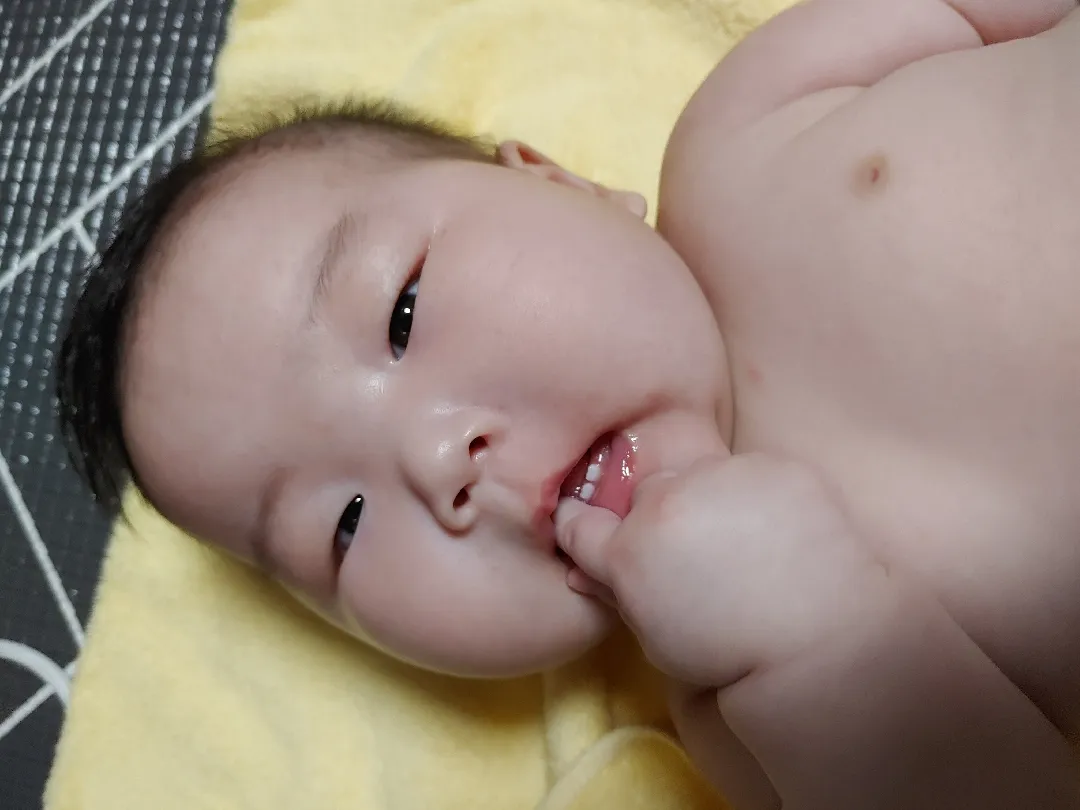 아랫니 두개 ㅠㅠ 