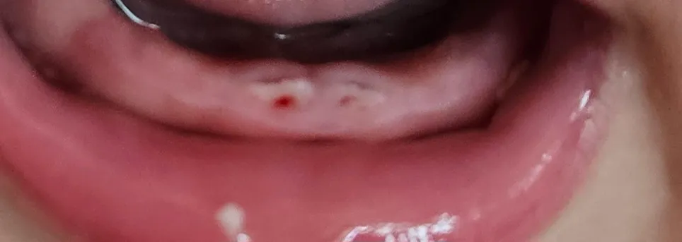 아기 아랫니 봐주세요ㅠ