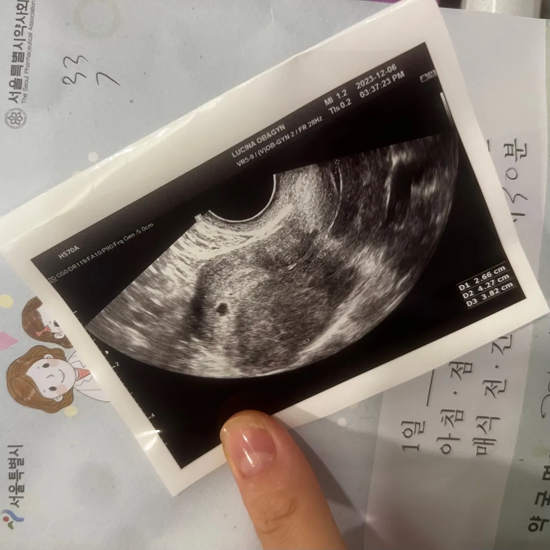 아기집보고왔어용