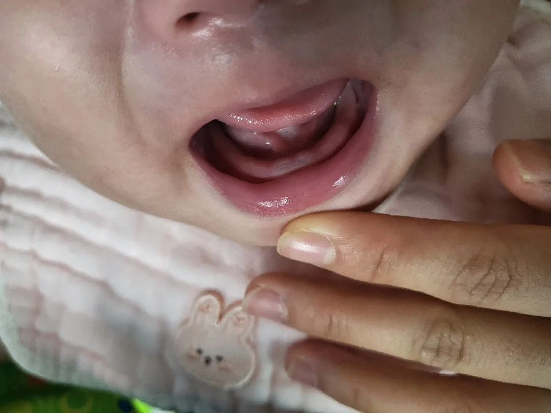 이앓이.....