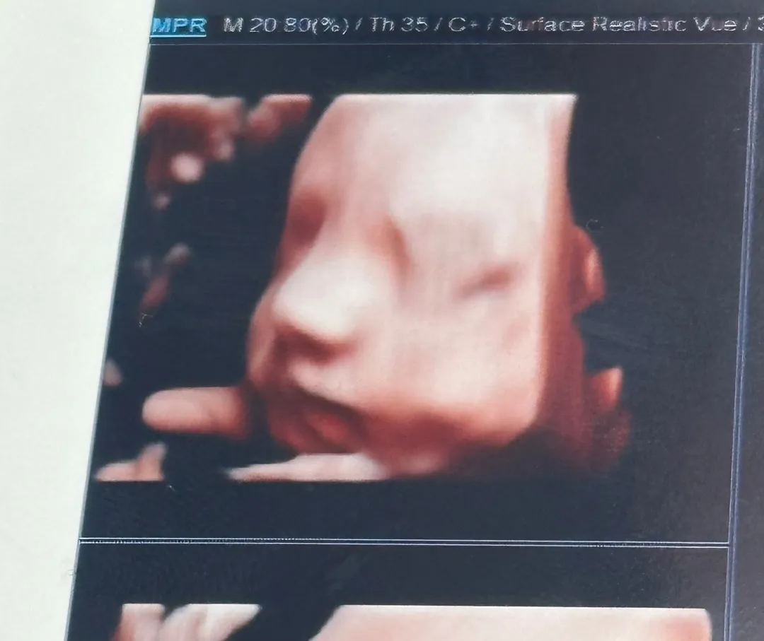 저도 입초 자랑하고 싶어용 