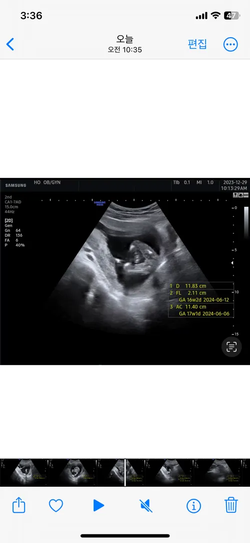 16주인데 성별너무궁금해요ㅜㅜ