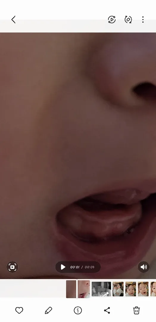 첫니가 안나요ㅠㅠ
