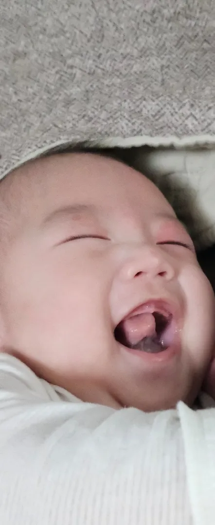 이앓이 슨배님들,,,,질문 좀요 😭