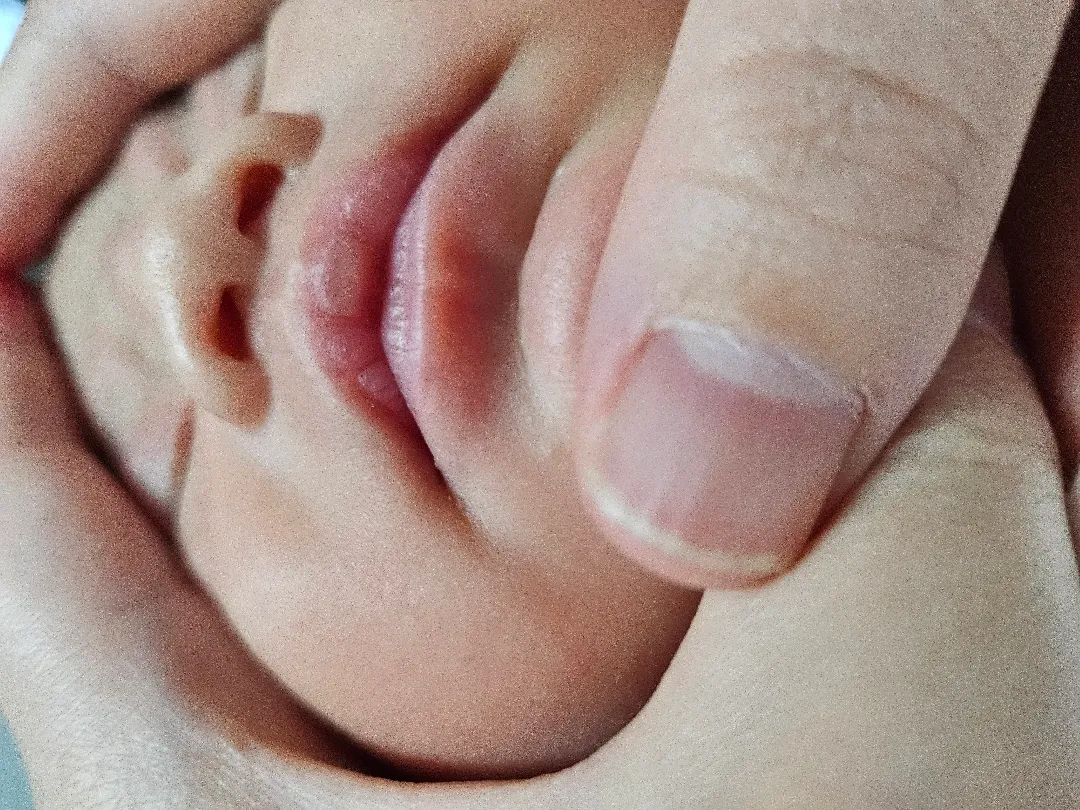 오늘 글 두번 쓰네요 🤣 와.. 코딱지 제거 처음 해봤어요(?) !!!