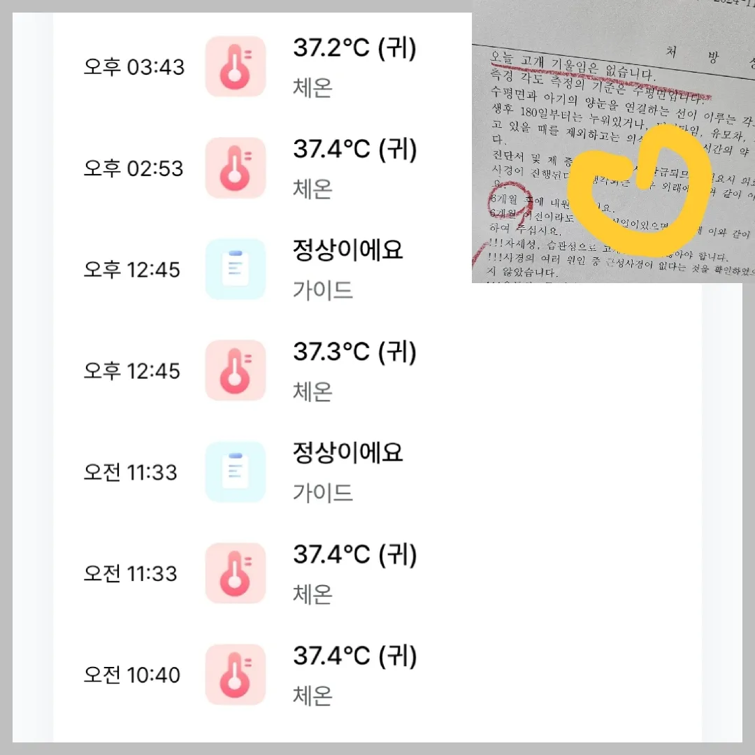 고열 전조 증상(?) 일까요? ㅠㅠㅠ
