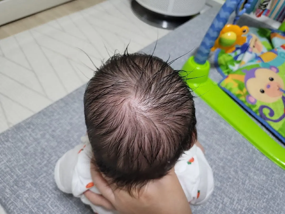 두상교정 돌려주면 좋아질까요??