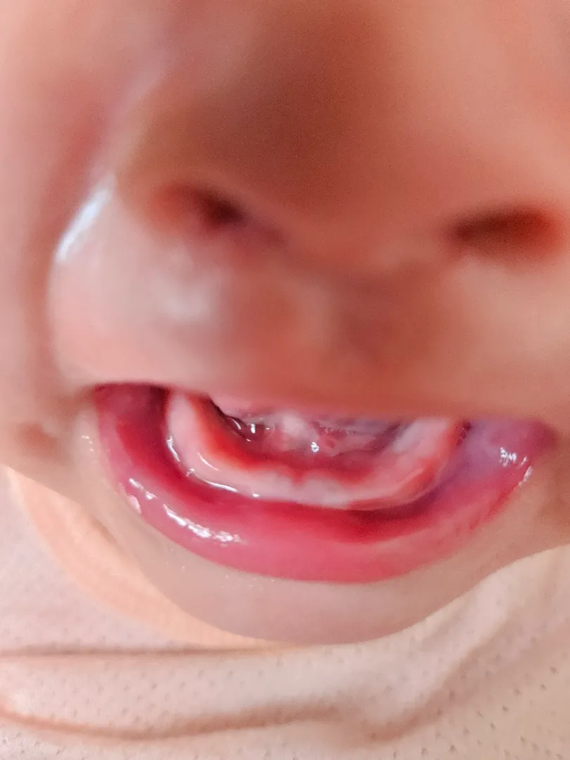 이가