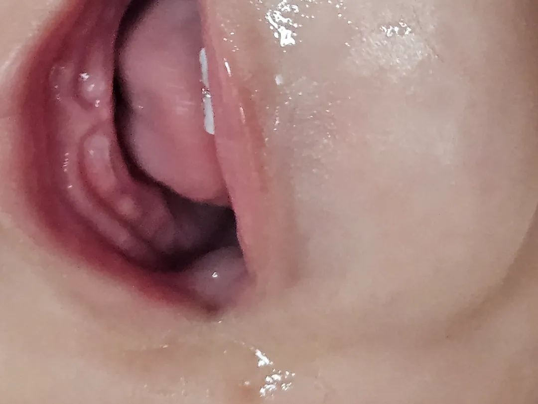 윗니뿅