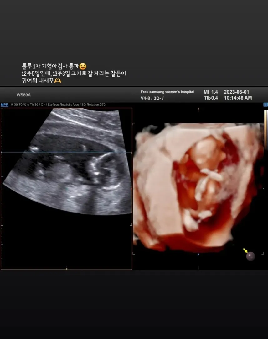 역시 베동이 최고에용🫶