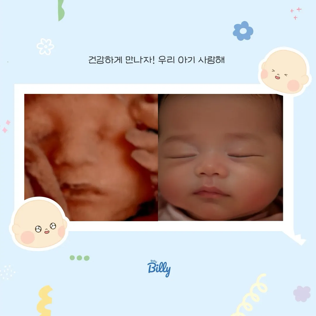 베이비빌리 입초 AI
