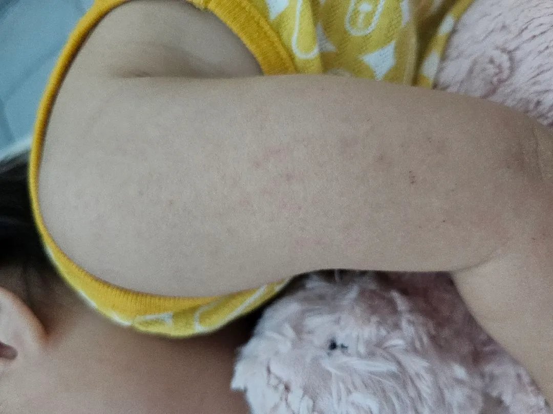 피부 좀 봐주세요 ㅠㅠㅠ