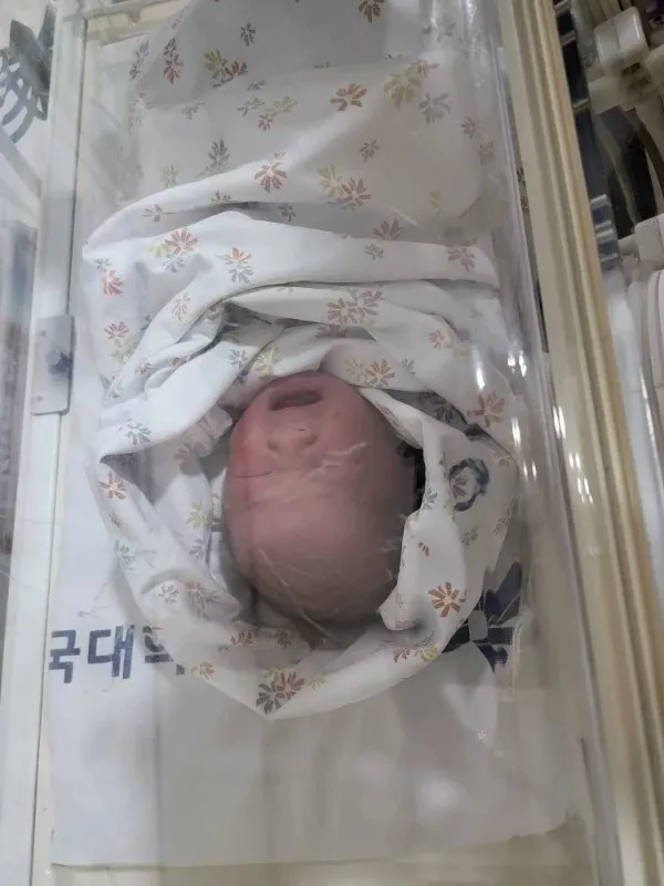 와 어제 출산했어요 ......!!!